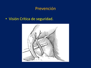 Prevención
• Visión Crítica de seguridad.

 