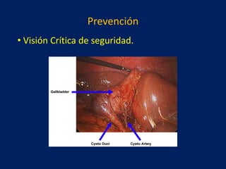 Prevención
• Visión Crítica de seguridad.

 