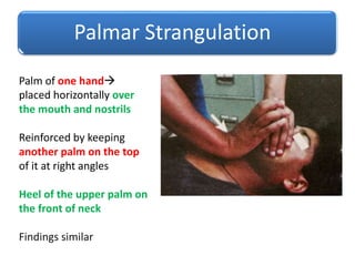 Strangulation Accessory Finger Mechanical asphyxia.pptx