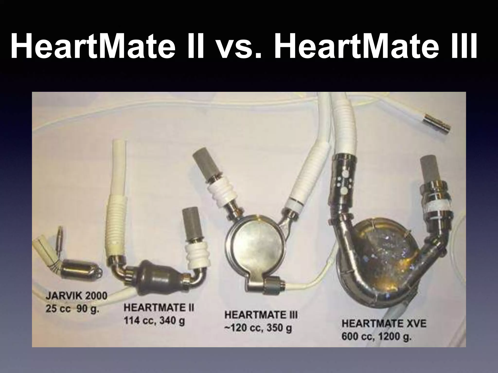 HeartMate II vs. HeartMate III
 