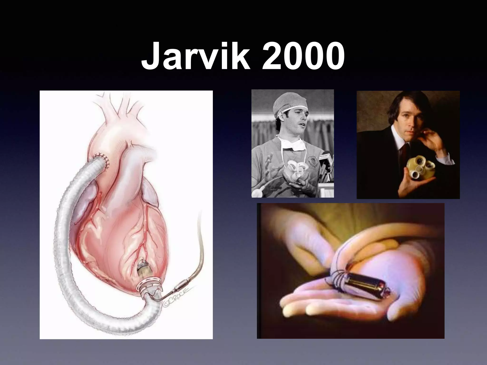 Jarvik 2000
 