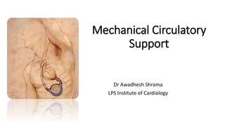 Mechanical Circulatory
Support
Dr Awadhesh Shrama
LPS Institute of Cardiology
 