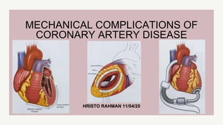 HRISTO RAHMAN 11/04/20
MECHANICAL COMPLICATIONS OF
CORONARY ARTERY DISEASE
 