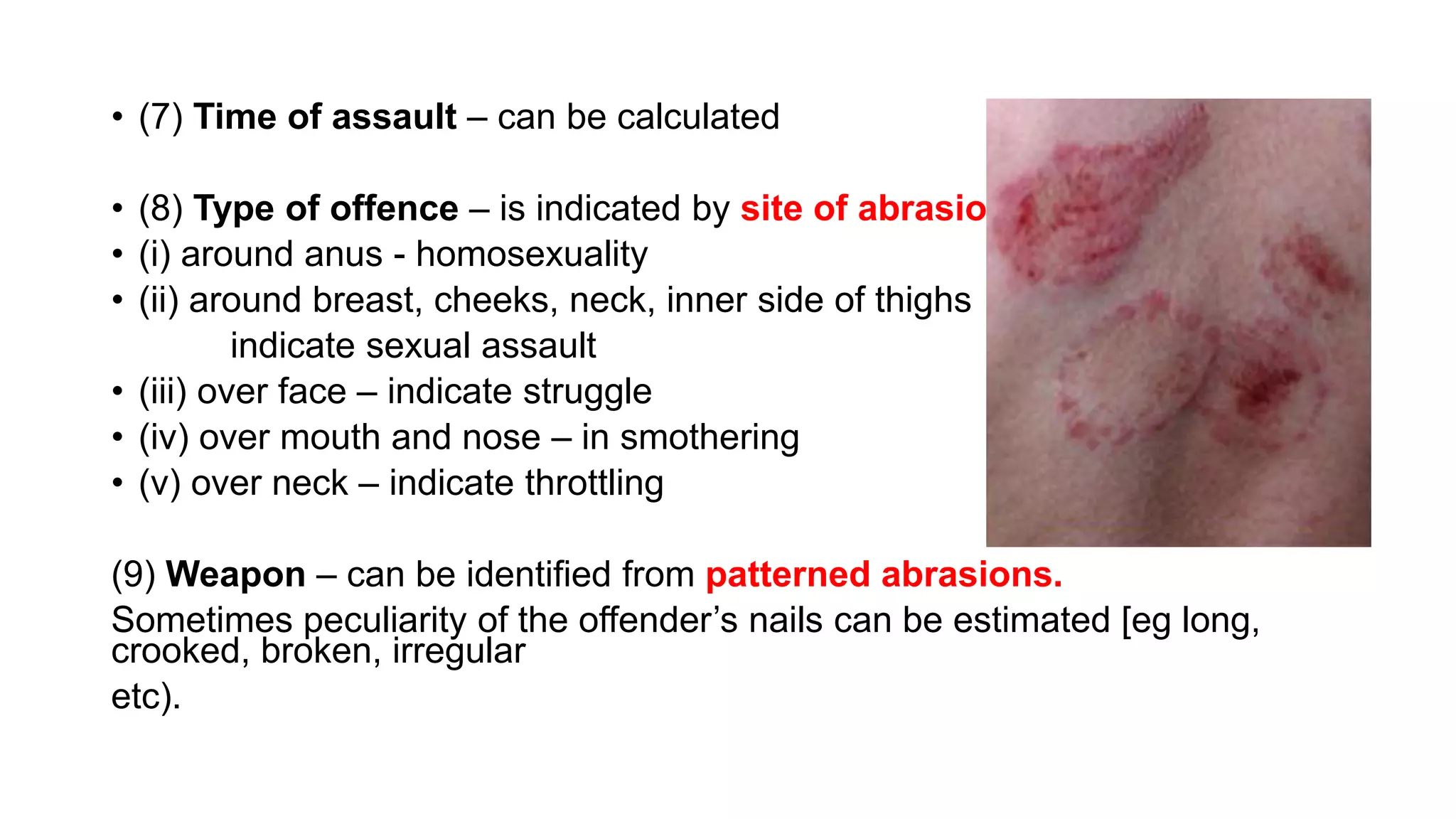 • (7) Time of assault – can be calculated
• (8) Type of offence – is indicated by site of abrasions
• (i) around anus - homosexuality
• (ii) around breast, cheeks, neck, inner side of thighs
indicate sexual assault
• (iii) over face – indicate struggle
• (iv) over mouth and nose – in smothering
• (v) over neck – indicate throttling
(9) Weapon – can be identified from patterned abrasions.
Sometimes peculiarity of the offender’s nails can be estimated [eg long,
crooked, broken, irregular
etc).
 