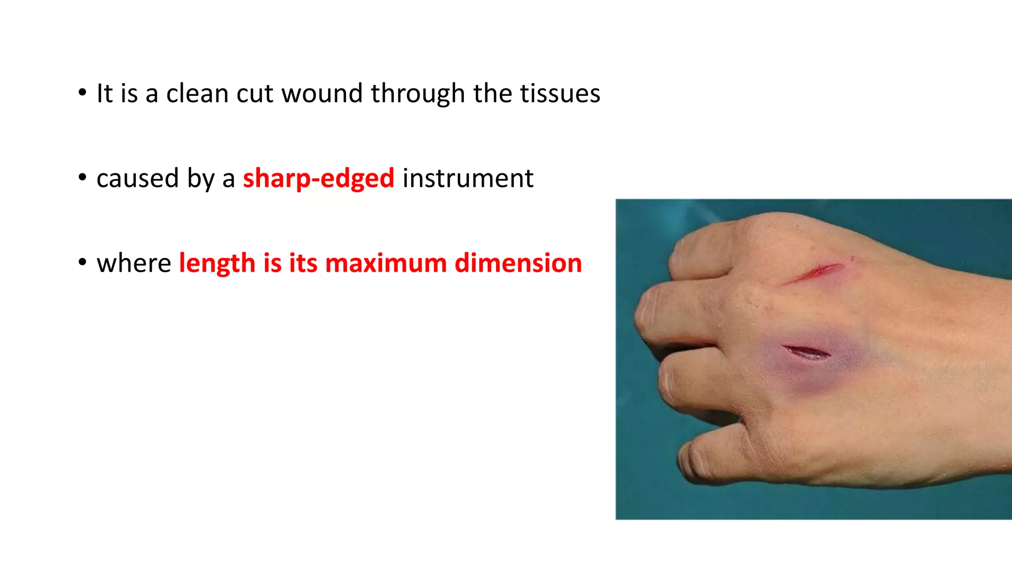 • It is a clean cut wound through the tissues
• caused by a sharp-edged instrument
• where length is its maximum dimension
 