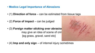 • Medico Legal Importance of Abrasions
• (1) Direction of force – can be estimated from tissue tags
• (2) Force of impact – can be judged
• (3) Foreign matter sticking over abrasions –
may give an idea of scene of crime
[eg grass, gravel, sand etc]
• (4) Imp and only sign – of internal injury sometimes
 