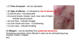 • (7) Time of assault – can be calculated
• (8) Type of offence – is indicated by site of abrasions
• (i) around anus - homosexuality
• (ii) around breast, cheeks, neck, inner side of thighs
indicate sexual assault
• (iii) over face – indicate struggle
• (iv) over mouth and nose – in smothering
• (v) over neck – indicate throttling
(9) Weapon – can be identified from patterned abrasions.
Sometimes peculiarity of the offender’s nails can be estimated [eg long,
crooked, broken, irregular
etc).
 