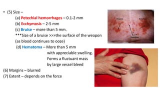 • (5) Size –
(a) Petechial hemorrhages – 0.1-2 mm
(b) Ecchymosis – 2-5 mm
(c) Bruise – more than 5 mm.
***Size of a bruise >>>the surface of the weapon
(as blood continues to ooze)
(d) Hematoma – More than 5 mm
with appreciable swelling.
Forms a fluctuant mass
by large vessel bleed
(6) Margins – blurred
(7) Extent – depends on the force
 