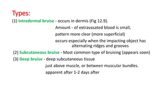 Types:
(1) Intradermal bruise - occurs in dermis (Fig 12.9).
Amount - of extravasated blood is small,
pattern more clear (more superficial)
occurs especially when the impacting object has
alternating ridges and grooves
(2) Subcutaneous bruise - Most common type of bruising (appears soon)
(3) Deep bruise - deep subcutaneous tissue
just above muscle, or between muscular bundles.
apparent after 1-2 days after
 