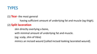 TYPES
(1) Tear- the most general
having sufficient amount of underlying fat and muscle (eg thigh).
(2) Split laceration
skin direclty overlying a bone,
with minimal amount of underlying fat and muscle.
(eg: scalp, shin of tibia)
mimics an incised wound [called incised looking lacerated wound].
 