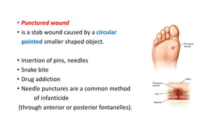 • Punctured wound
• is a stab wound caused by a circular
pointed smaller shaped object.
• Insertion of pins, needles
• Snake bite
• Drug addiction
• Needle punctures are a common method
of infanticide
(through anterior or posterior fontanelles).
 