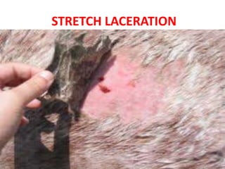 STRETCH LACERATION
 