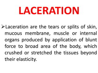 LACERATION
Laceration are the tears or splits of skin,
mucous membrane, muscle or internal
organs produced by application of blunt
force to broad area of the body, which
crushed or stretched the tissues beyond
their elasticity.
 