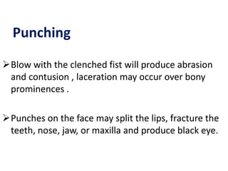 Punching
Blow with the clenched fist will produce abrasion
and contusion , laceration may occur over bony
prominences .
Punches on the face may split the lips, fracture the
teeth, nose, jaw, or maxilla and produce black eye.
 