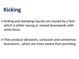 Kicking
Kicking and stamping injuries are caused by a foot
which is either swung or moved downwards with
some force.
They produce abrasions, contusion and sometimes
lacerations , which are more severe than punching.
 