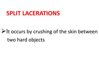 SPLIT LACERATIONS
It occurs by crushing of the skin between
two hard objects
 