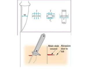 Sharp Force Instruments Mechanical injuries(ICS) due to sharp force.ppt