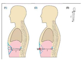 Sharp Force Trauma Radiograph Mechanical injuries(ICS) due to sharp force.ppt