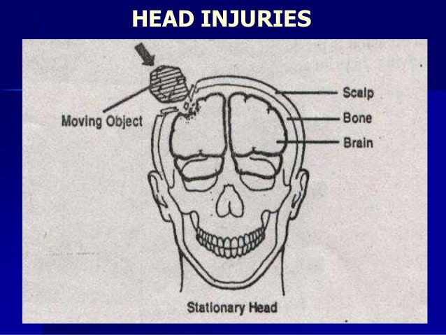 mechanical injury 1 mechanical injury