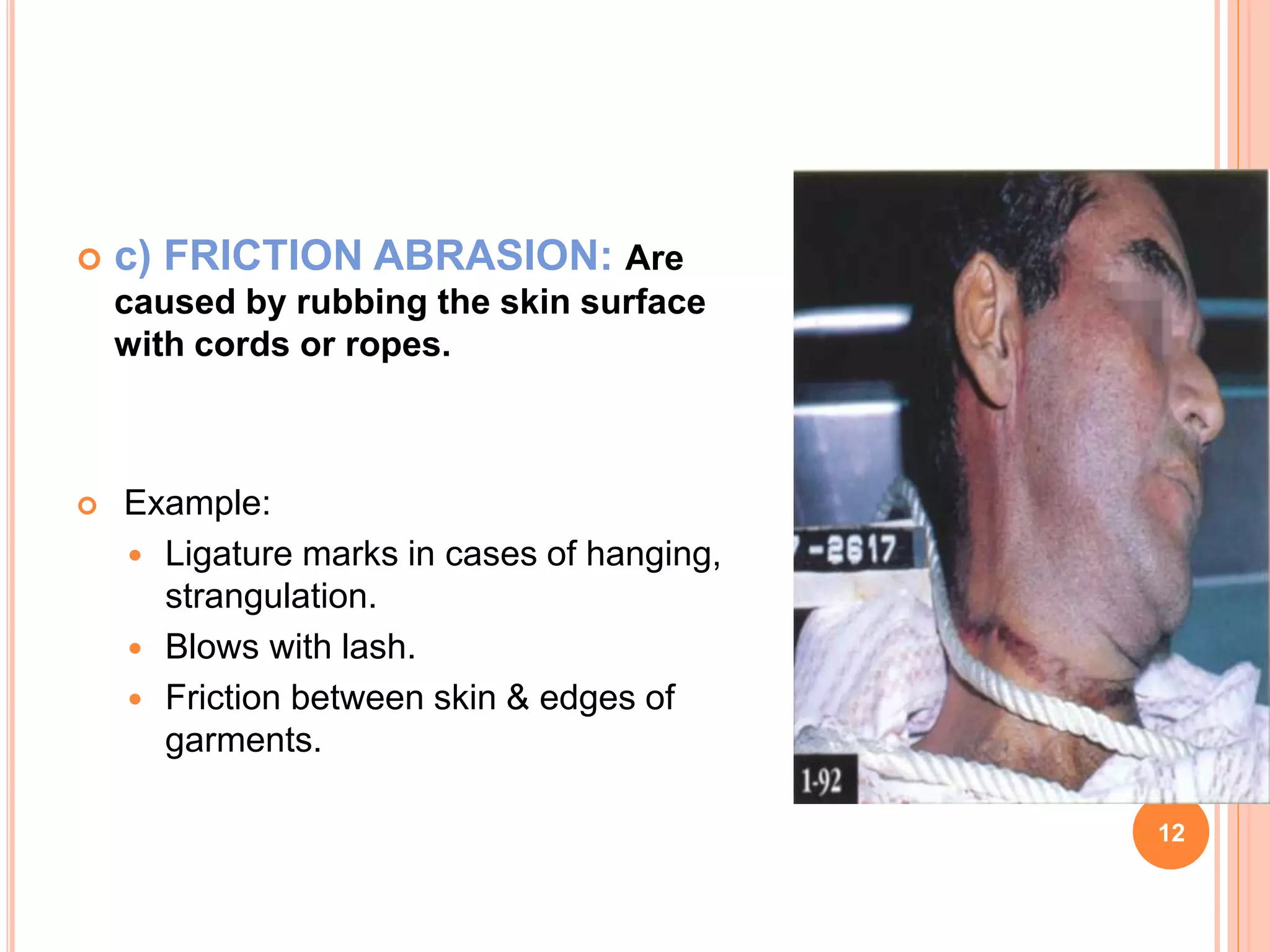 Mechanical injury 2 | PPTX