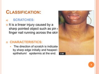 Raspberry Scratch Injury Mechanical injury 2 | PPTX