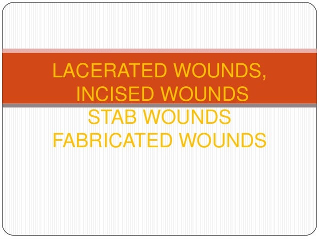 FABRICATED WOUNDS EBOOK DOWNLOAD FABRICATED WOUNDS EBOOK DOWNLOAD