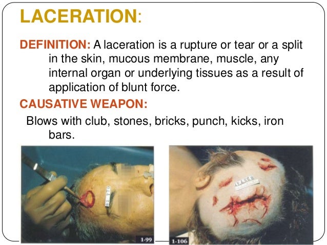 mechanical injury