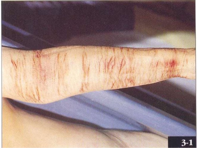 FABRICATED WOUNDS EBOOK DOWNLOAD FABRICATED WOUNDS EBOOK DOWNLOAD
