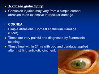  1- Closed globe injury
 Contusion injuries may vary from a simple corneal
abrasion to an extensive intraocular damage.
• CORNEA
• Simple abrasions: Corneal epithelium Damage
(Ulcer)
 These are very painful and diagnosed by fluorescein
staining.
 These heal within 24hrs with pad and bandage applied
after instilling antibiotic ointment.
 