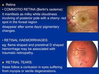  Retina
• COMMOTIO RETINA (Berlin's oedema):
It manifests as milky white cloudiness
involving of posterior pole with a cherry- red
spot in the foveal region
disappear after some days/ pigmentary
changes.
• RETINAL HAEMORRHAGES:
eg: flame shaped and preretinal D shaped
hemorrhage may be associated with
traumatic retinopathy.
 RETINAL TEARS:
these follow a contusion in eyes suffering
from myopia or senile degenerations.
 