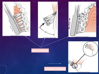 Charters method
Bass method
 