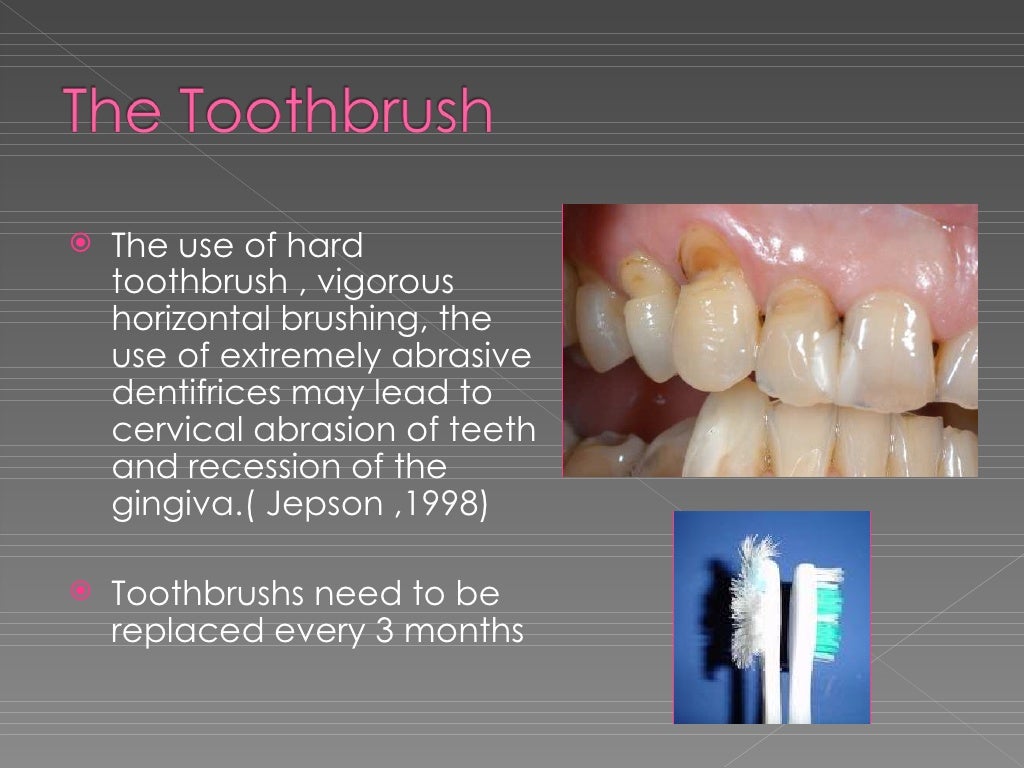 Mechanical plaque control