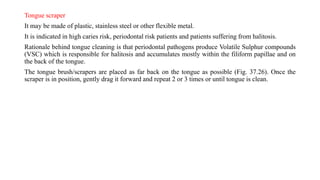 Tongue scraper
It may be made of plastic, stainless steel or other flexible metal.
It is indicated in high caries risk, periodontal risk patients and patients suffering from halitosis.
Rationale behind tongue cleaning is that periodontal pathogens produce Volatile Sulphur compounds
(VSC) which is responsible for halitosis and accumulates mostly within the filiform papillae and on
the back of the tongue.
The tongue brush/scrapers are placed as far back on the tongue as possible (Fig. 37.26). Once the
scraper is in position, gently drag it forward and repeat 2 or 3 times or until tongue is clean.
 