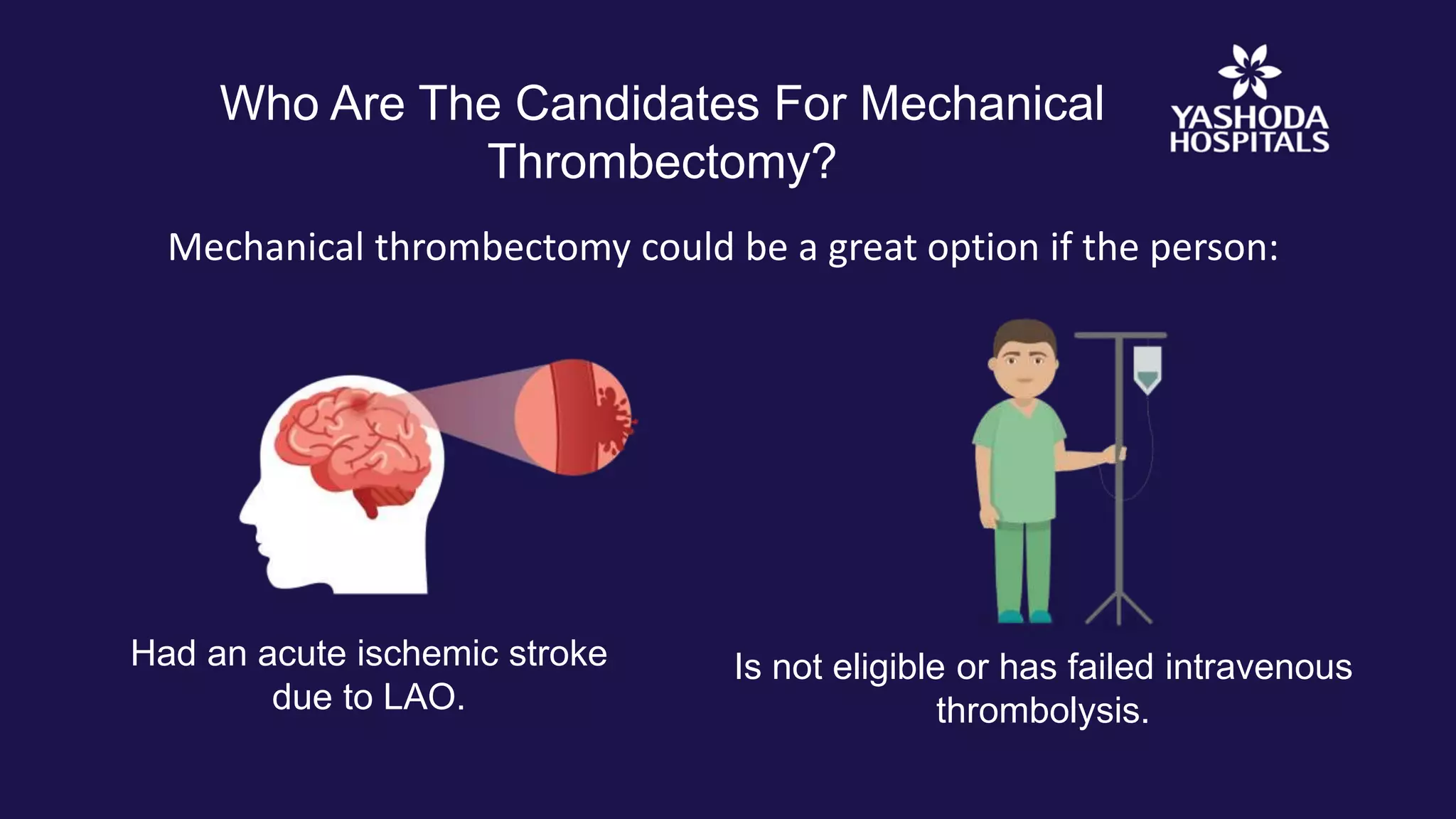 Mechanical Thrombectomy for Acute Ischemic Stroke | Brain Stroke ...