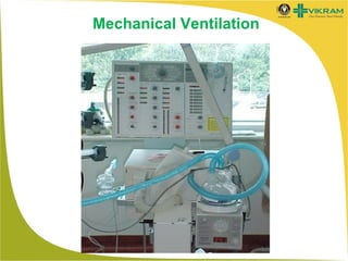 Mechanical Ventilation

 