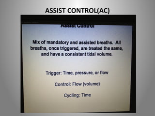 ASSIST CONTROL(AC) 
 