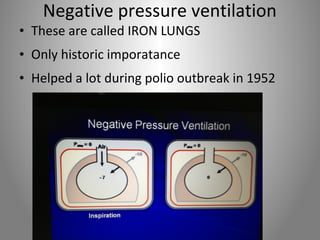 Negative pressure ventilation 
• These are called IRON LUNGS 
• Only historic imporatance 
• Helped a lot during polio outbreak in 1952 
 