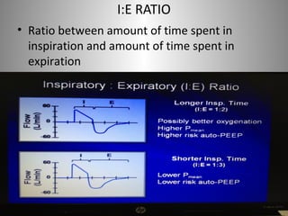 I:E RATIO 
• Ratio between amount of time spent in 
inspiration and amount of time spent in 
expiration 
 