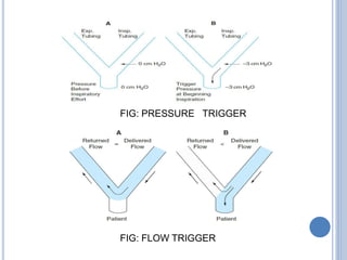 Trigger Api Air Flow Mechanical ventilation | PPTX