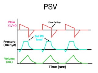 Mechanical ventilation | PPT