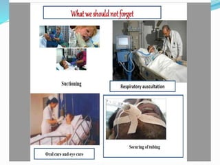 mechanical ventilation.pptx