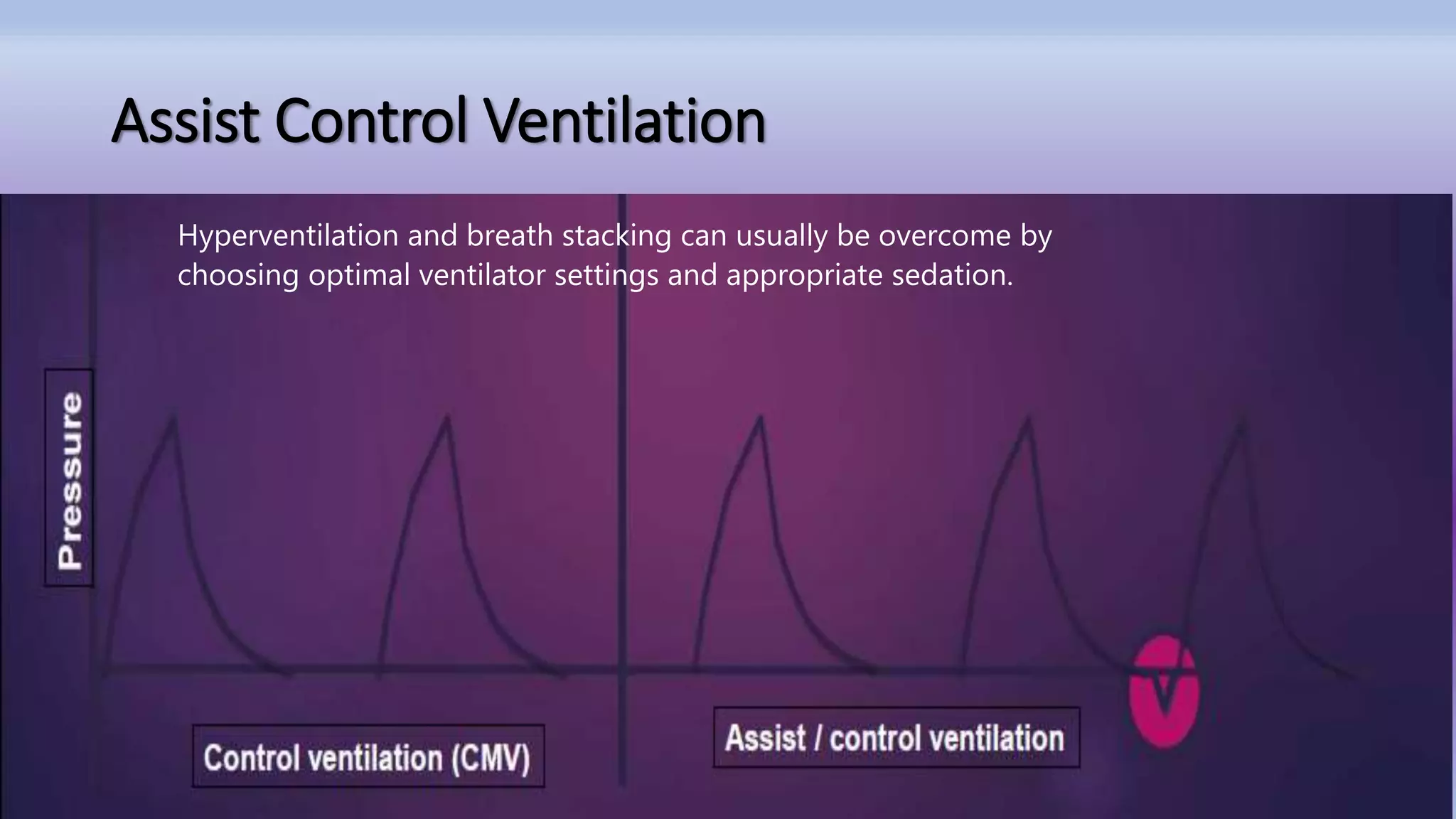 Mechanical Ventilation.pptx