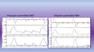 Imv Path Mechanical Ventilation.pptx
