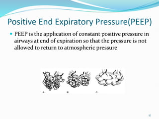 Peep Explained Mechanical Ventilation Lecture Presentation.pptx