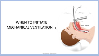 Mechanical ventilation different modes .pdf