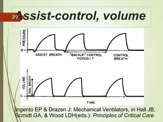 Comprehensive Guide to Mechanical Ventilation in Pediatric Care | PPT