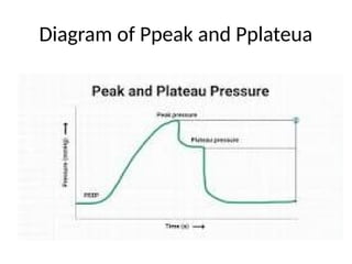 Comprehensive Overview of Mechanical Ventilation: Modes, Monitoring ...