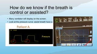 How do we know if the breath is
control or assisted?
• Many ventilator will display on the screen.
• Look at the pressure curve: assist breath have a negative deflection right before inspiration
 