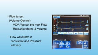 • Flow target
(Volume Control)
VCV: We set the max Flow
Rate,Waveform, & Volume
• Flow waveform is
consistent and Pressure
will vary
 