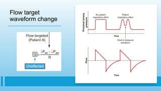 Flow target
waveform change
 